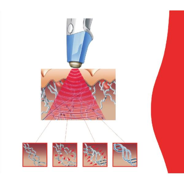 Машина красоты радиочастоты потери веса оборудования красоты РФ уменьшения целлюлита