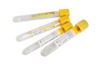 PET Glass Yellow Gel Clot Activator Tube 9ml Serum Separator Tube