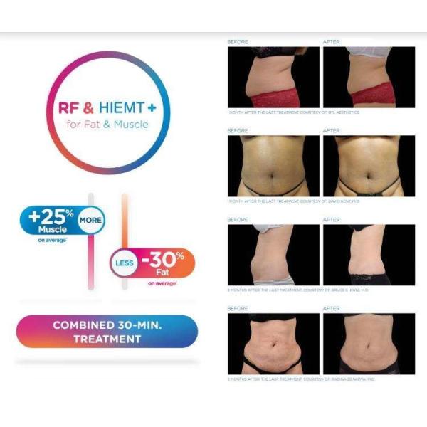 машина тела EMS высокой интенсивности 3000W ваяя для бедренных костей оружий взваливает на плечи