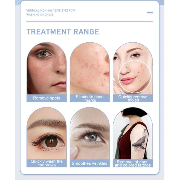 ODM 1200w q переключил машину шелушения углерода машины лазера ND YAG