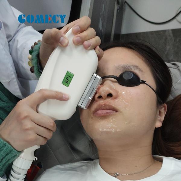 Ipl Permanent Hair Removal Ipl Skin Rejuvenation Hair Removal Freckles Removing Device
