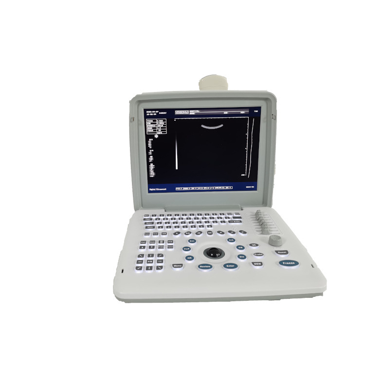 Metal See Laptop B W Portable Pregnancy Doppler Probe Scanner Radio Fetal Ultrasound Machine For Baby