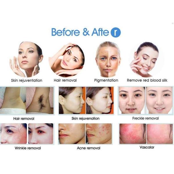 Magneto Optical 1200nm IPL Laser Hair Removal Machine 8.4 Inch LCD Screen