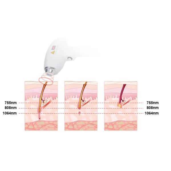 Unwanted Hair Removal Machine , Three Wavelength Non Channel Diode Laser Equipment