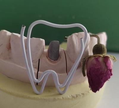 Metal Dental Post And Core After Endodontic Treatment