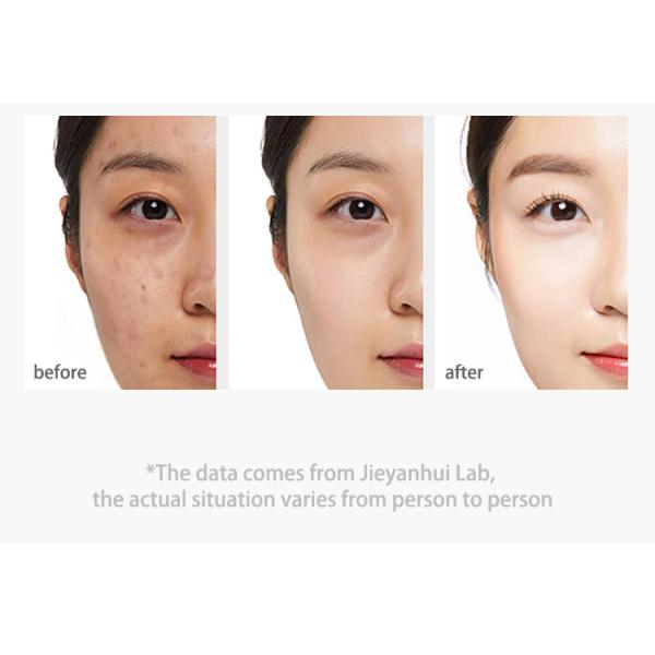 Vitamine C d'ODM Rose Petals Essence Face Serum pour la peau encline d'acné sensible