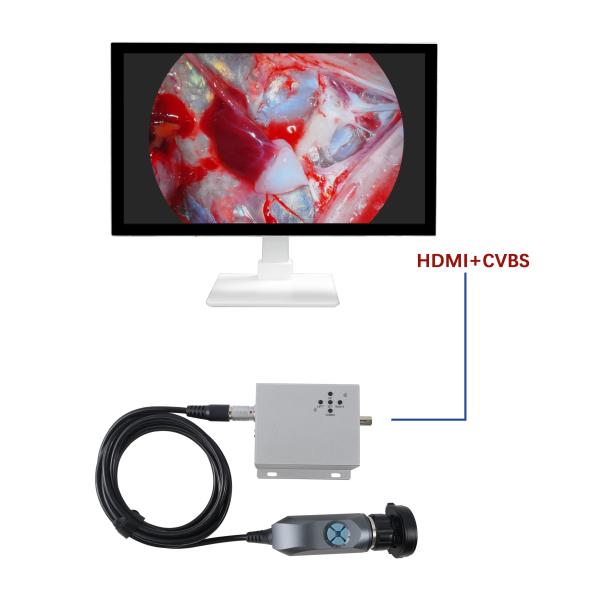 Portable 1080p Endoscopic Camera System For Ent Dr Gynecology Endoscopy Direct From Manufacturer
