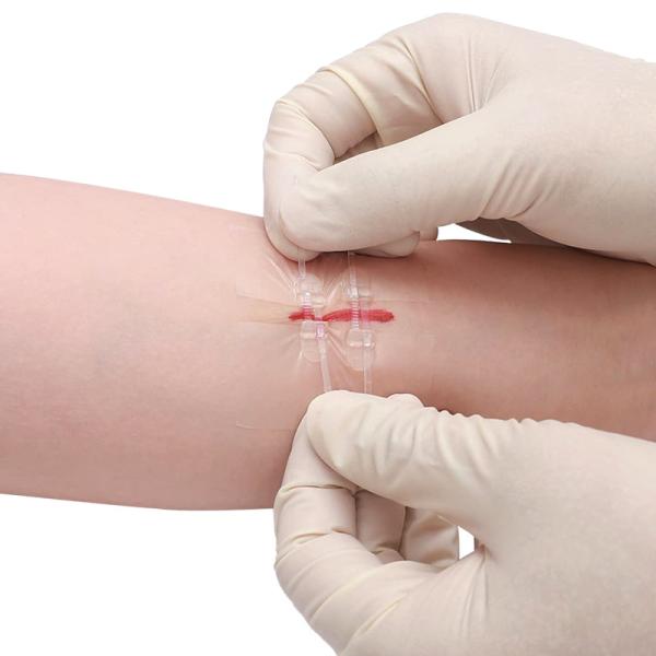 Dispositif de fermeture de plaie de bandages en tissu flexible 2 / 4 / 6PCS