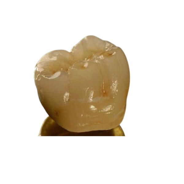 Inter Miscibility Porcelain Dental Crown