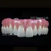 Customized Implant Teeth Bridge Implanting Guide Look Like Natural Teeth Restore Oral Health, Function and Appearance