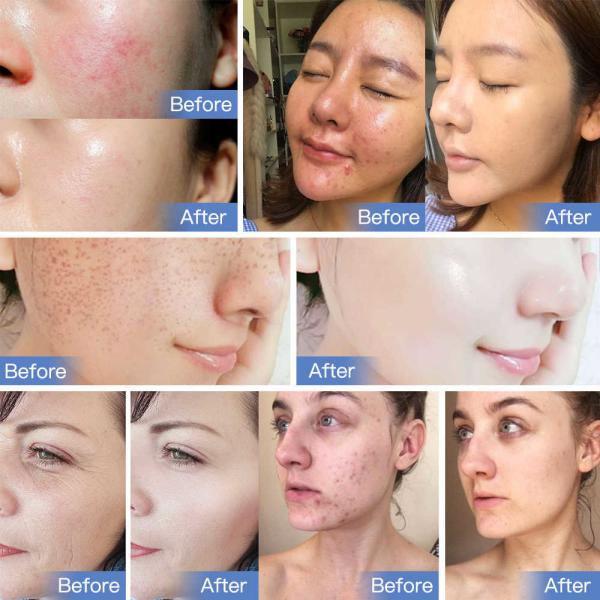 Красота кожи 7 цветов вертикальная привела светлую лицевую машину для подмолаживания кожи