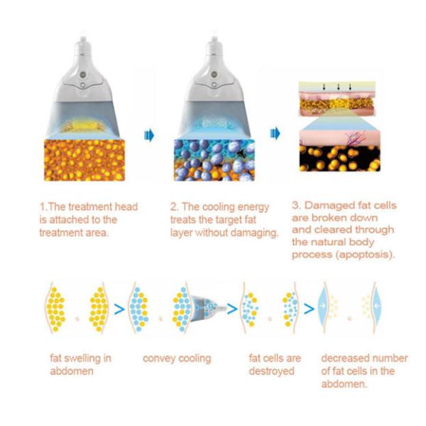 RF 360 Cryolipolysis Slimming Machine Non Invasive Cavitation ISO90 Approval