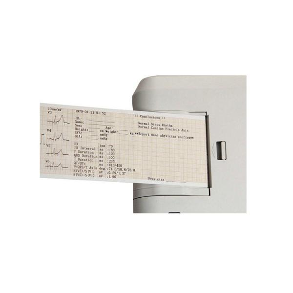 3 Channel Digital Ecg Machine Pathological Analysis Equipments OEM