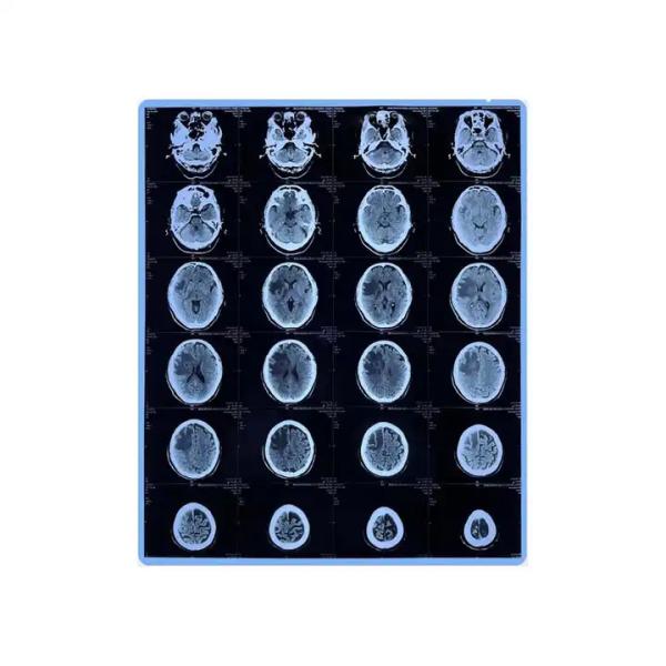 Medical X Ray Film Dry Thermal For Printer