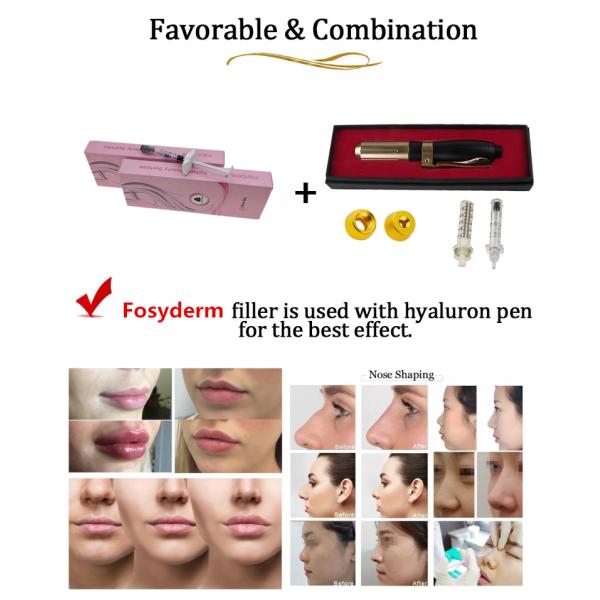 Перекрестный соединенный Hyaluronic кисловочный заполнитель ручки 2ml дермальный для губ