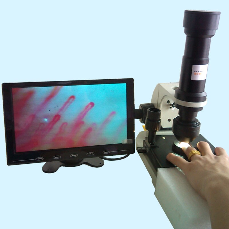 Точный прибор микроскопа микроциркуляции капилляра Nailfold LCD цвета для sub проверять здоровья