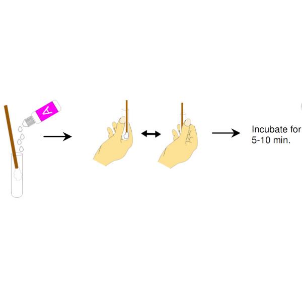 Аксессуары наборов пробирки домашние испытывая полные, точность набора 96% теста дома чламидии