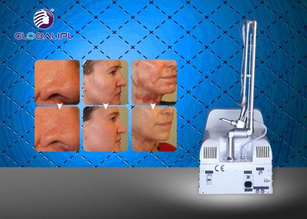 Face Lift Laser Co2 Fractional / Co2 Fractional Laser Equipment 6 Kinds Scan Mode