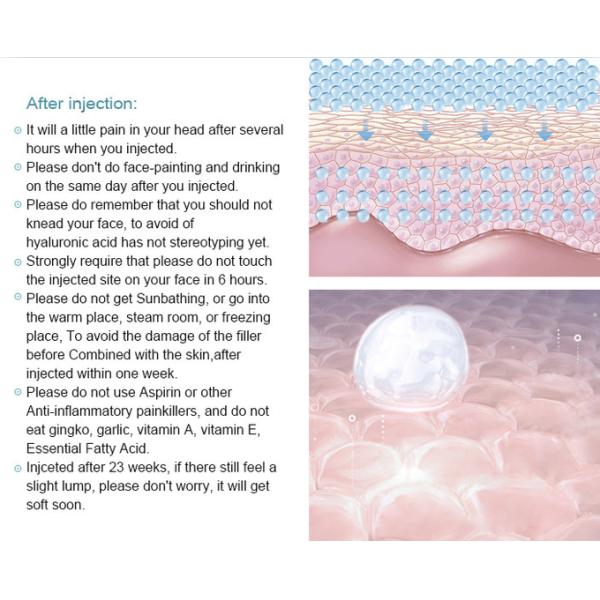 Transformación de labios Aumento de labios con ácido hialurónico Relleno no quirúrgico