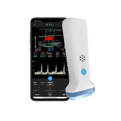 12.6cm Portable Color Doppler Ultrasound Scanner For Healthcare Professionals