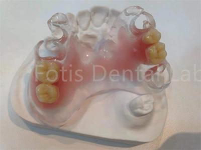 Hypoallergenic Stain Resistant TCS Valplast Dental Prosthetics For Long Lasting Comfort