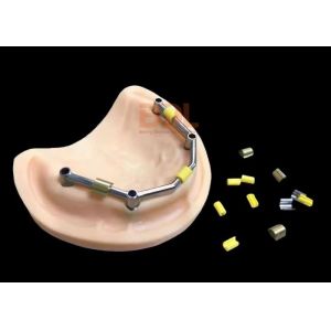 9mm Implant Bar Malong Bridge Grade 5 Titanium Alloy Precision Engineered Dental