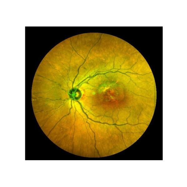 Equipo oftálmico de Angiograph Digital 160° de la retina