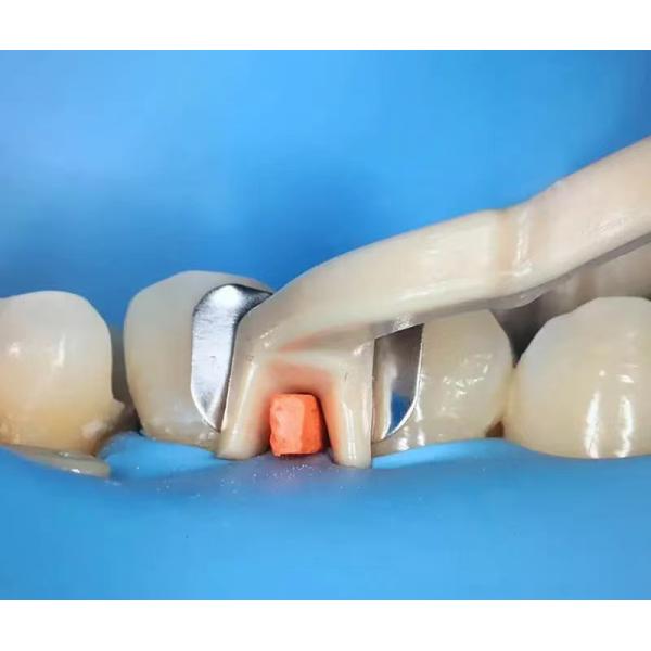 Dental Sectional Matrix System F2 Autoclavable includes Sectional Matrix Bands M2 + Resin Clamping Ring R3