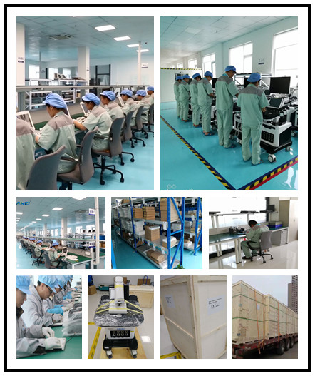 15 Inch LCD Medical Ultrasound Machine Scanner Trolley B Mode Examination Therapy Equipments