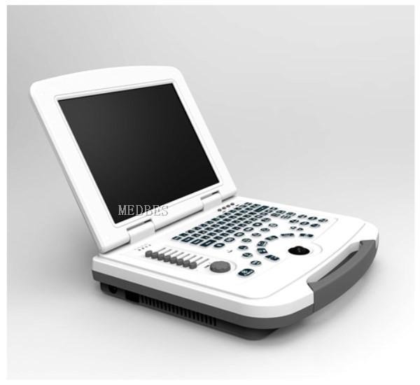Clinic Hospital  Obstetrics and Gynecology Department Laptop Ultrasound Machine with Battery