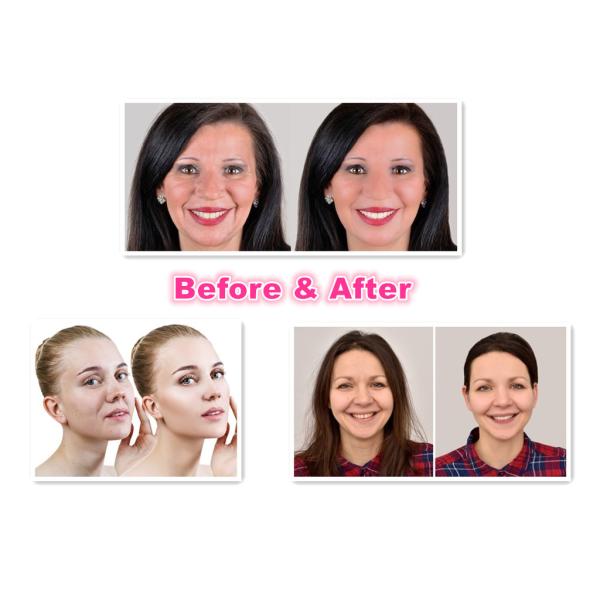 Белая впрыска Allergan 100iu Botox для лицевого Botulinum токсина