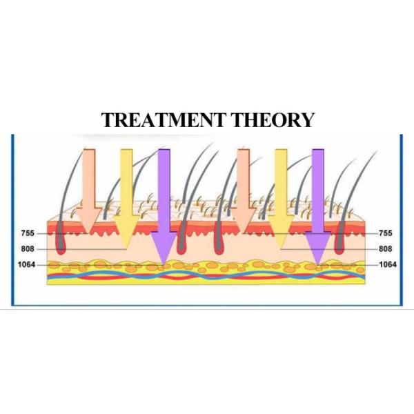 Portable Diode Hair Remover Laser Machine , 808nm Diode Laser Machine