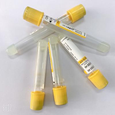 Escolha os tubos da coleção do sangue da flebotomia PRP do tubo do gel do uso e do ativador do coágulo