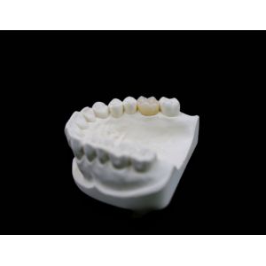 Zirconia Dental Lab Outsourcing Services CAD/CAM Milling Metal Free
