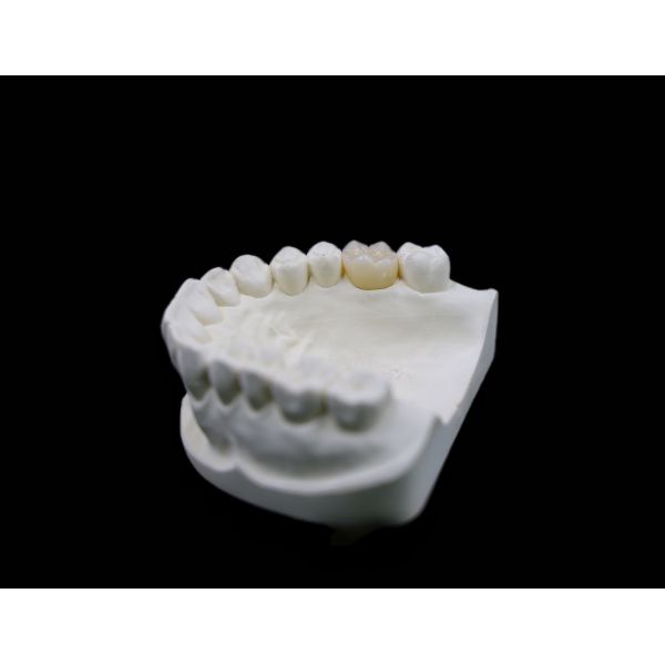 Zirconia Dental Lab Outsourcing Services CAD/CAM Milling Metal Free