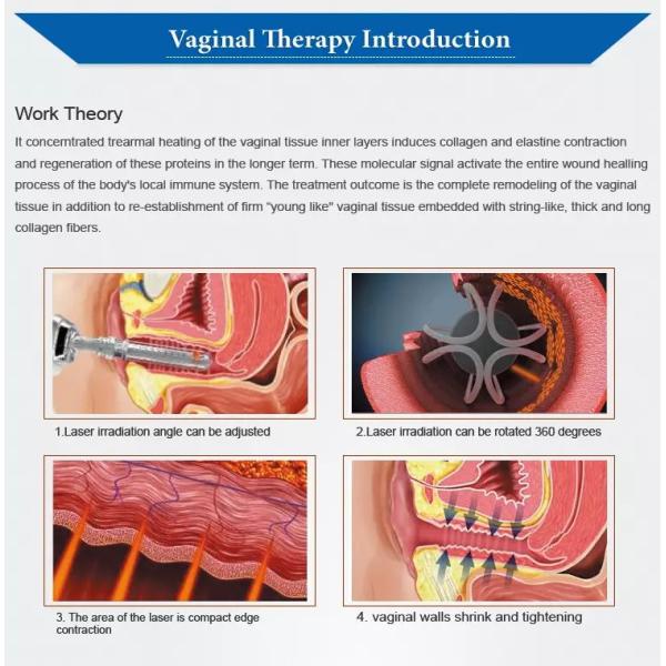 Scar Removal Fractional CO2 Laser Beauty Equipment With 10.4 Inch LCD Touch Screen