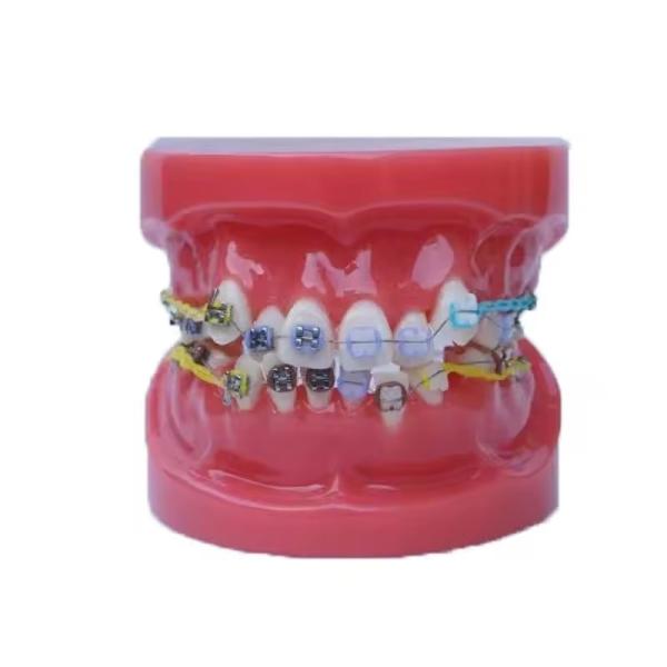 Treinamento Uso de Dentes Dentários Modelo de Ensino Modelo Ortodôntico Dental Funcional Sem Bracket