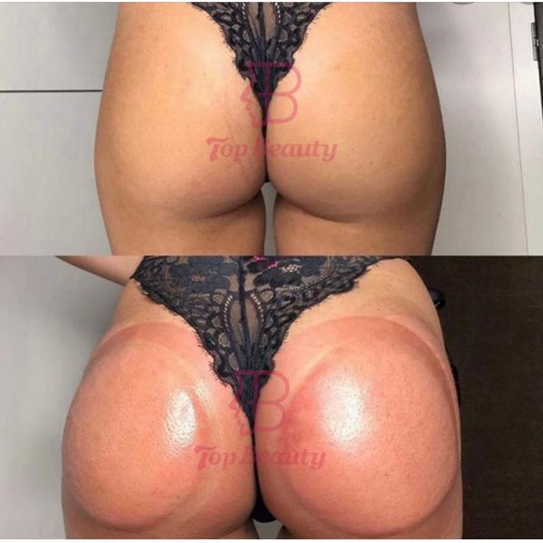 massager усиливающего агента груди вакуума чашки увеличения батокс машина батта электронного придавая форму чашки поднимаясь