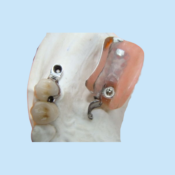 Denture приложения точности зубоврачебной лаборатории продолжительный пятнает устойчивый