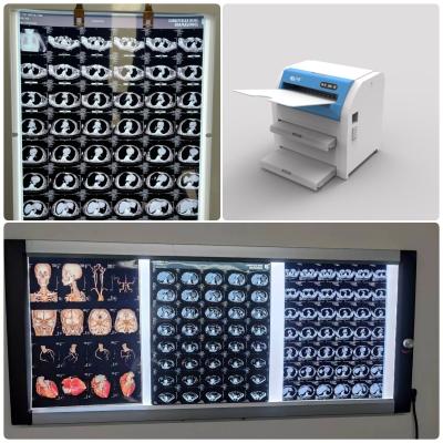 11x14 14x17 Medical Dry Fuji Film With Maximum Transmission Density ≥3.0 D