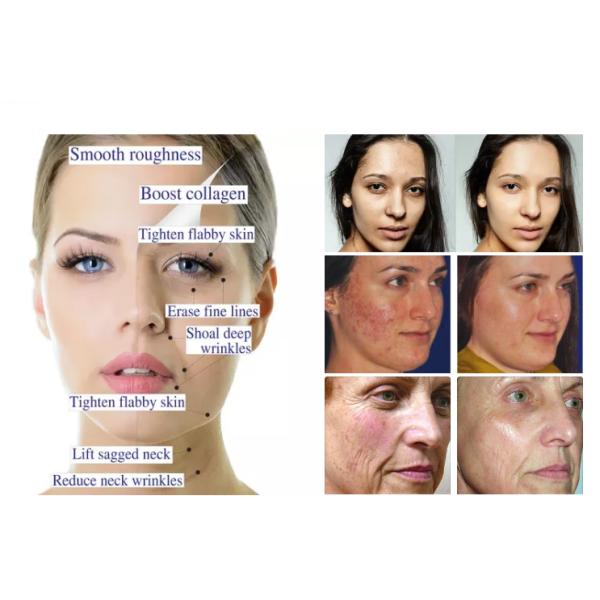 Hyaluronic медицинское холодное обжатие 3pcs/box наклеивает лицевой укреплять