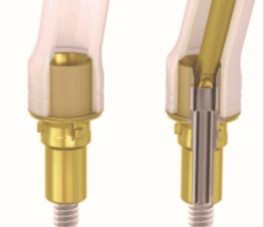 Natural ASC Angled Screw Channel Dental Implants Crown