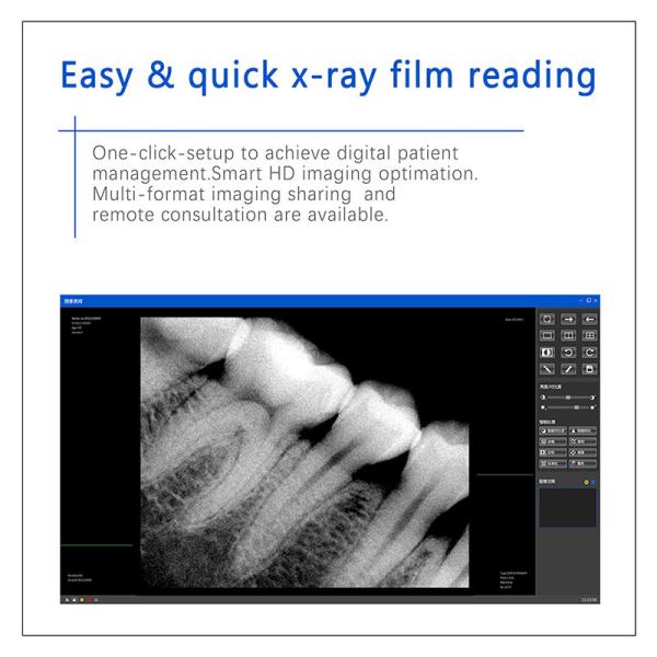 Dental X-Ray Digital Sensor For Dental Implant And Endodontic Treatment