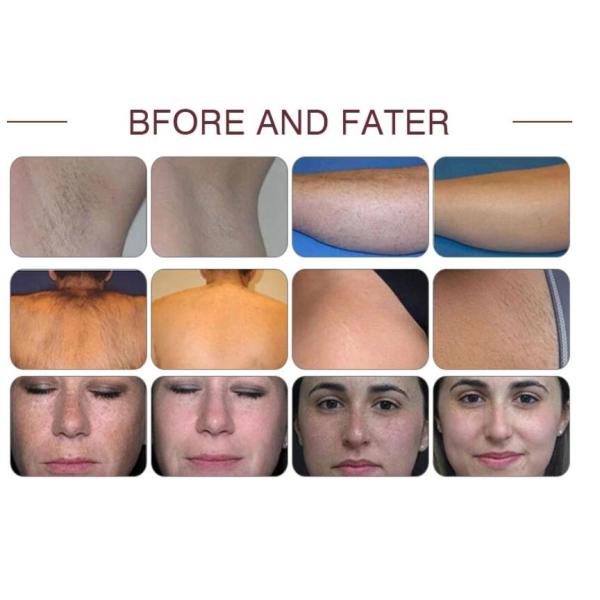 Multi Functional IPL Beauty Equipment For Hair Removal / Vascular Therapy