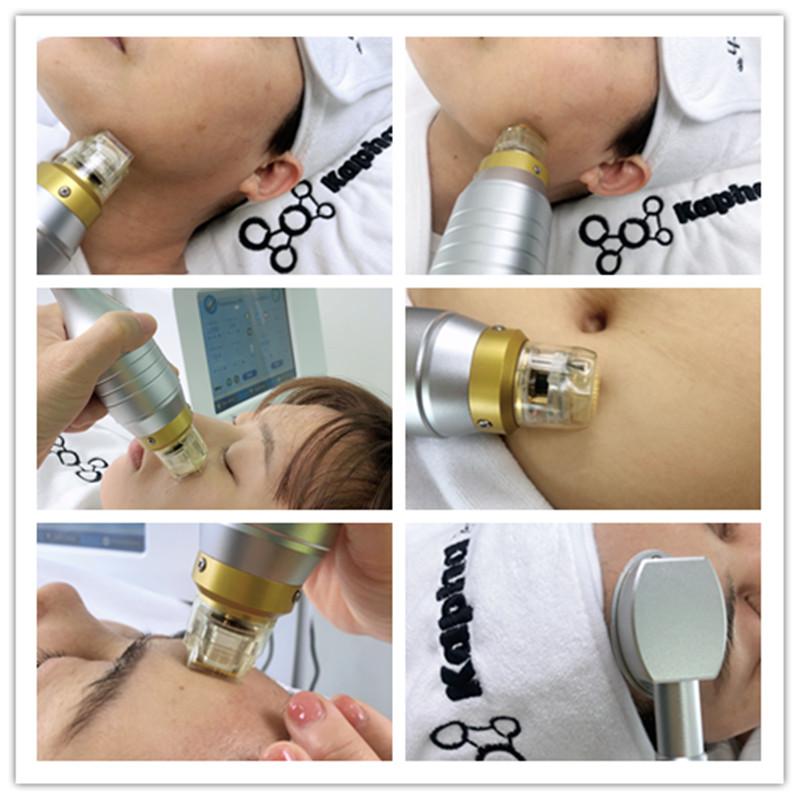 Индукция 220V Microneedling частичный RF коллагена тела