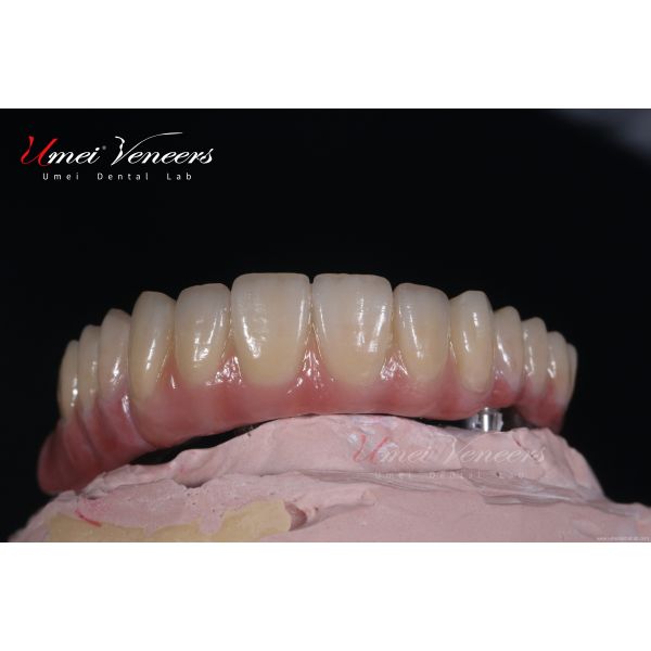 Sturdy zirconium oxide bridge frame