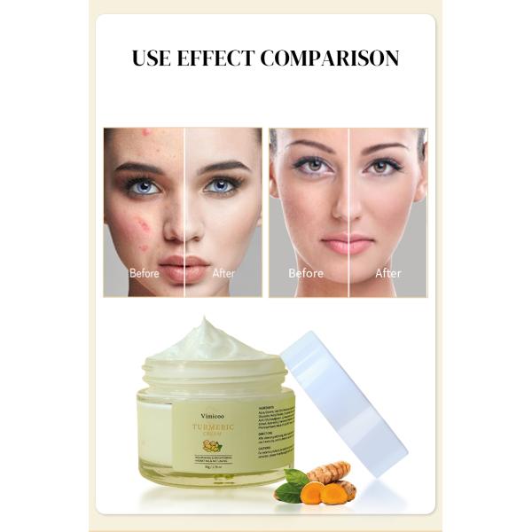 Beauty Skin Care Private Label Natural Organic Repairing Moisturizer Tumeric Turmeric Facial Cream for Face