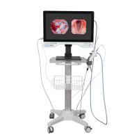 FHD tout en un système de caméra d'endoscope intégré LED Light & Flexible Scope pour la laparoscopie
