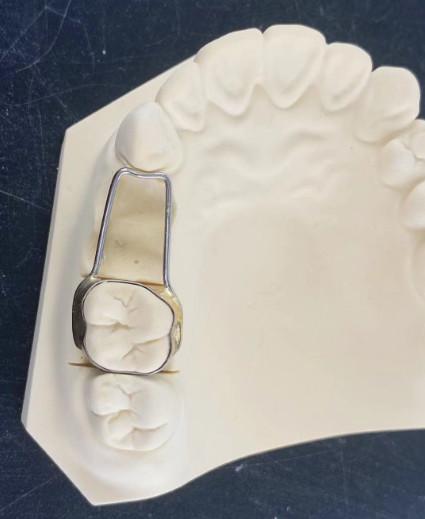 High Accuracy Orthodontic Removable Appliance Safety Clear Hawley Retainer