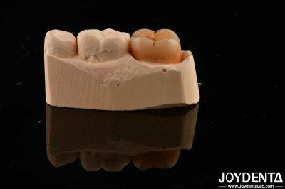 Dental Restoration Material Multilayer Full Zirconia 1200 HV Hardness Crack Resistance